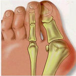 1Pair=2Pcs Bunion Protector Feet Care Orthotics Pedicure Tool Hallux Valgus Corrector Orthopedic Adjuster Bunion Foot Massager