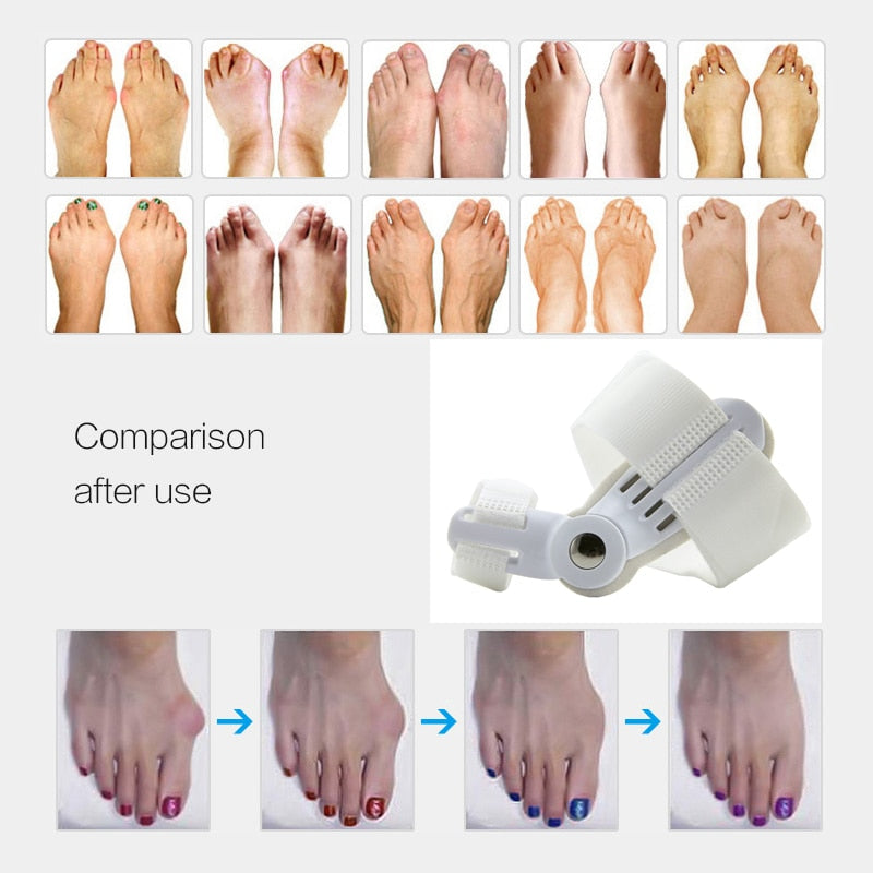 1Pair=2Pcs Bunion Protector Feet Care Orthotics Pedicure Tool Hallux Valgus Corrector Orthopedic Adjuster Bunion Foot Massager