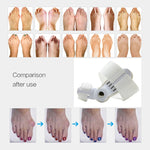 1Pair=2Pcs Bunion Protector Feet Care Orthotics Pedicure Tool Hallux Valgus Corrector Orthopedic Adjuster Bunion Foot Massager