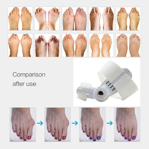 1Pair=2Pcs Bunion Protector Feet Care Orthotics Pedicure Tool Hallux Valgus Corrector Orthopedic Adjuster Bunion Foot Massager
